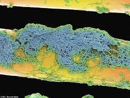 Oral Microbiome and the Impacts on Systemic Health